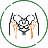 変形性股関節症(股関節の痛み)