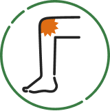 変形性膝関節症(膝の痛み)