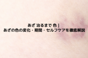 あざ 治るまで 色｜あざの色の変化・期間・セルフケアを徹底解説