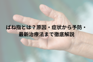 ばね指とは？原因・症状から予防・最新治療法まで徹底解説