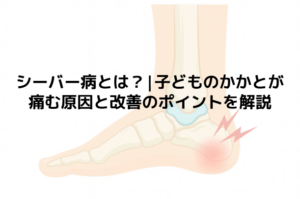 シーバー病とは？|子どものかかとが痛む原因と改善のポイントを解説