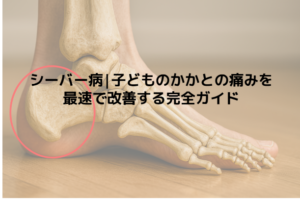 シーバー病|子どものかかとの痛みを最速で改善する完全ガイド