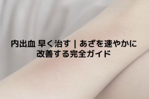 内出血 早く治す｜あざを速やかに改善する完全ガイド