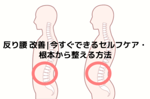 反り腰 改善|今すぐできるセルフケア・根本から整える方法