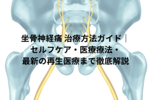 坐骨神経痛 治療方法ガイド｜セルフケア・医療療法・最新の再生医療まで徹底解説