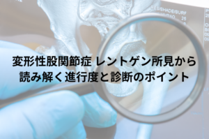 変形性股関節症 レントゲン所見から読み解く進行度と診断のポイント