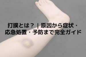 打撲とは？ | 原因から症状・応急処置・予防まで完全ガイド