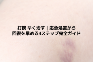 打撲 早く治す｜応急処置から回復を早める4ステップ完全ガイド