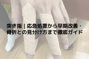 突き指｜応急処置から早期改善・骨折との見分け方まで徹底ガイド
