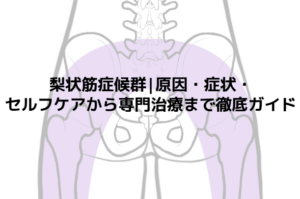 梨状筋症候群|原因・症状・セルフケアから専門治療まで徹底ガイド